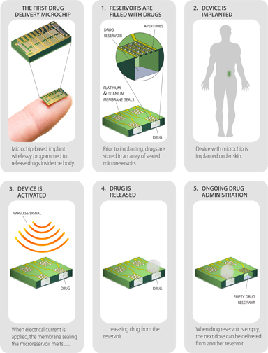 Microchip Birth Control