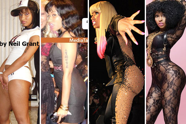 niki_minaj_plastic-surgery-before-and-after-photos